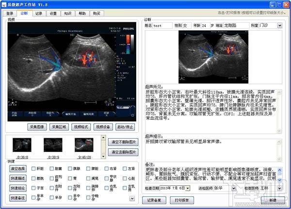 易捷超声工作站,易捷超声工作站下载,易捷超声工作站官方下载